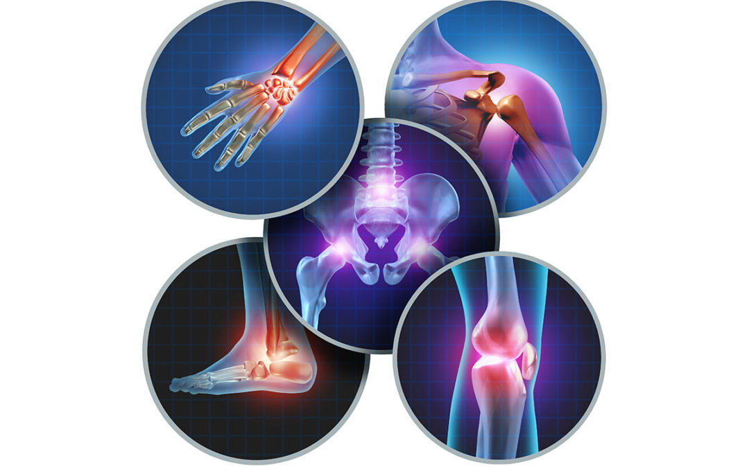 Avid Sports Medicine - Arthritis