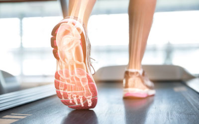 Plantar Fasciitis: Symptoms, Causes, and Treatments
