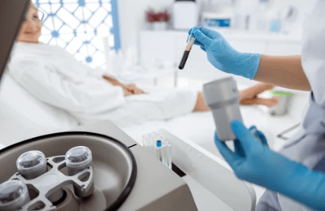 PRP Therapy in San Francisco