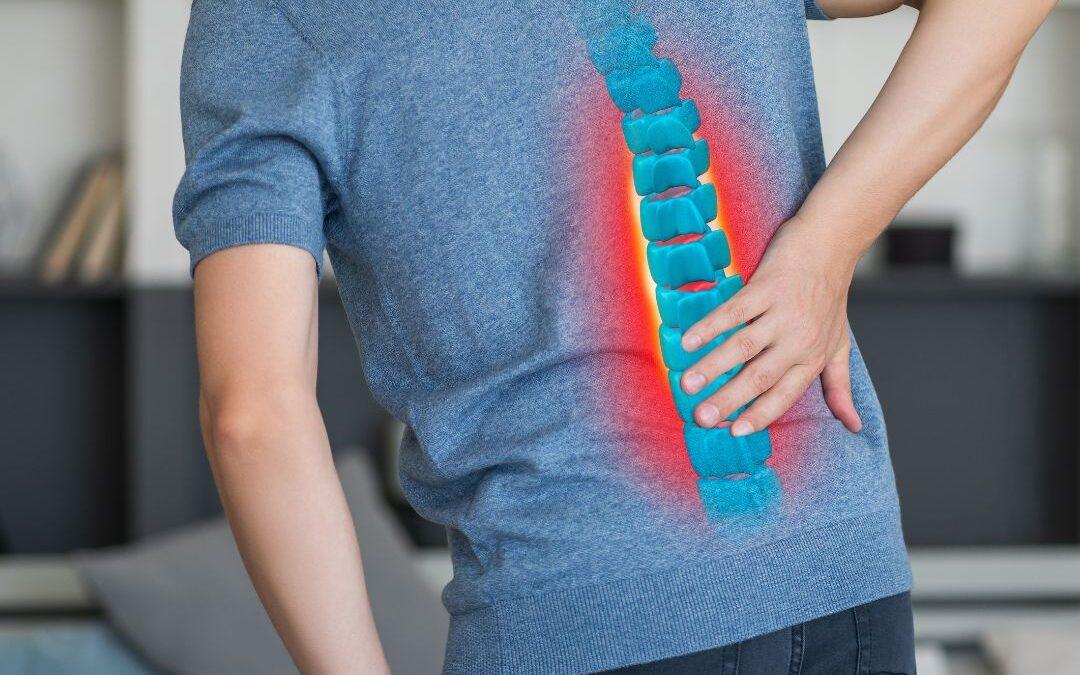 Spinal Stenosis - Physical Therapy - Avid Sports Medicine - San Francisco