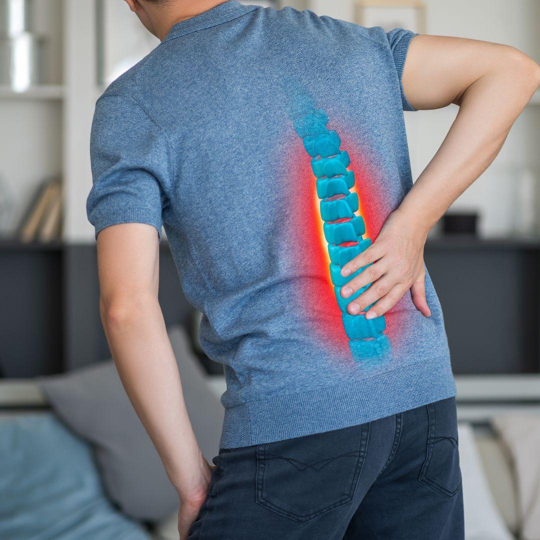 Physical Therapy for Spinal Stenosis | San Francisco | Avid Sports