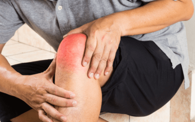 Stem Cell Procedure for Knee Injuries