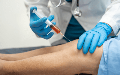 PRP Knee Injection: A Revolutionary Treatment for Joint Pain Relief