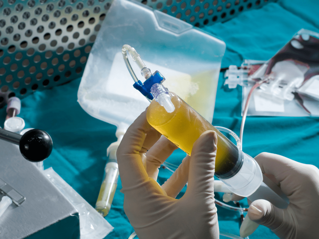 What Is Lipogems Treatment? | Avid Sports Medicine
