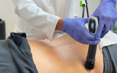 Is Shockwave Therapy Worth It?