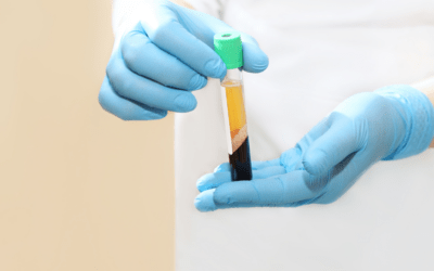 Platelet Rich Plasma (PRP): Healing for Athletes