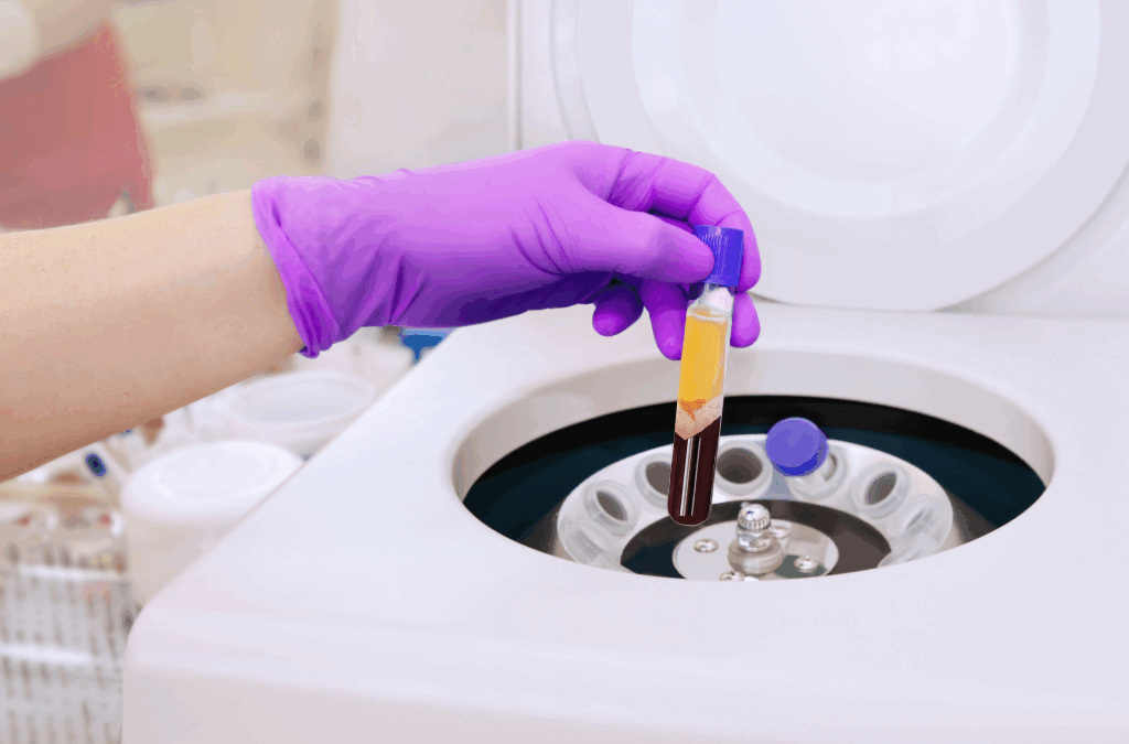PRP can help with chronic pain
