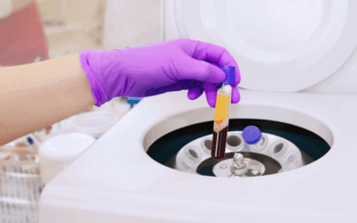 Platelet Rich Plasma for Chronic Tendonitis