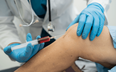 Post-Treatment Care: What You Should Do After Stem Cell Injection