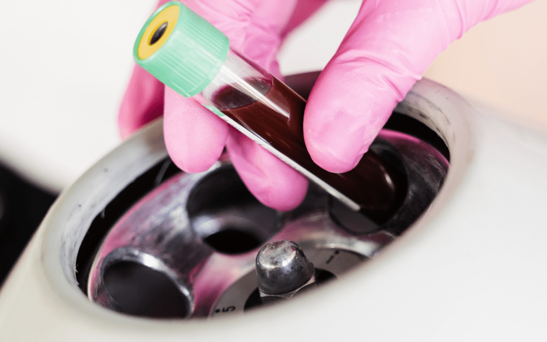 Platelet rich plasma