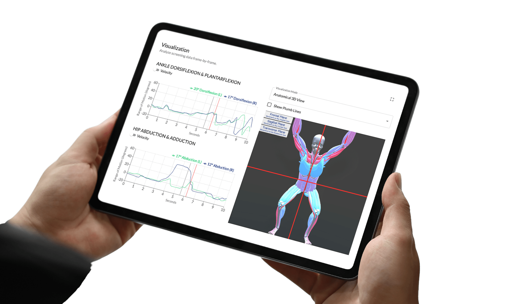 a-person holds a tablet displaying motion analysis