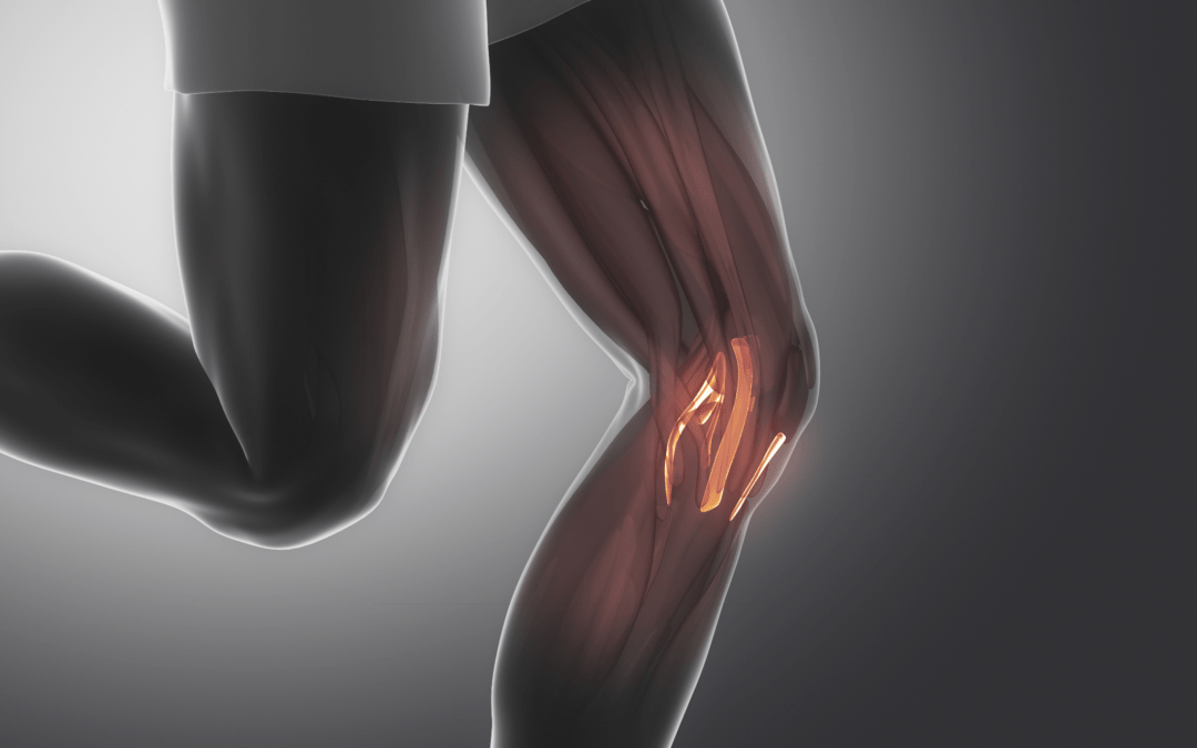 Connective Tissue Knee Pain