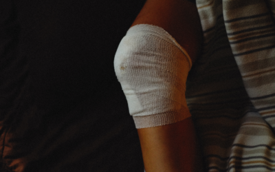 Recovery From Knee Replacement: Timeline, Rehab, And Strength
