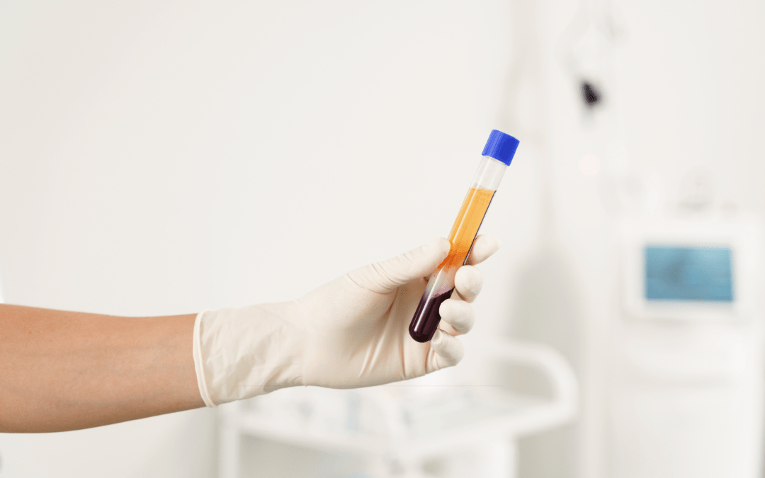 PRP therapy at Avid Sports Medicine
