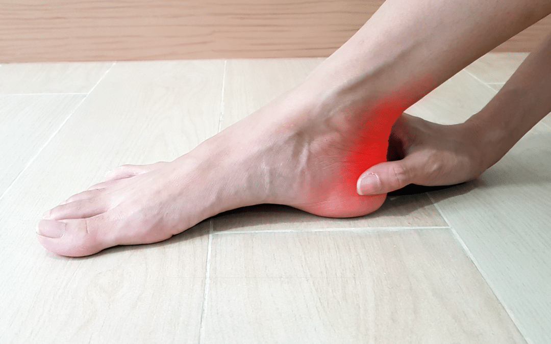 Strained Achilles treatment at Avid Sports Medicine